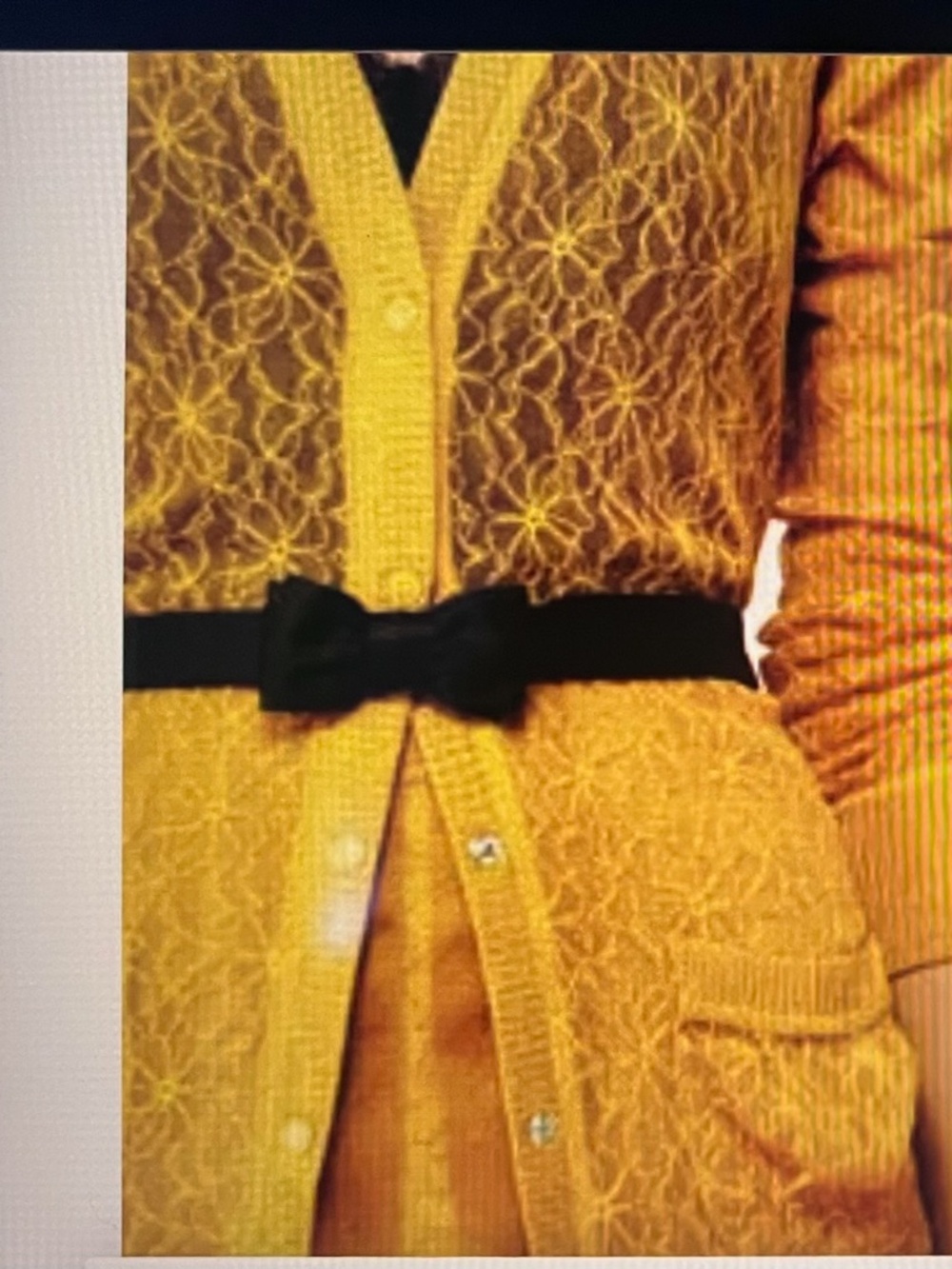 NEW Rodarte Yellow Lace Button down Cardigan SIZE XS RARE